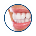 высокоэстетичные виниры в стоматологии ТоталСтом